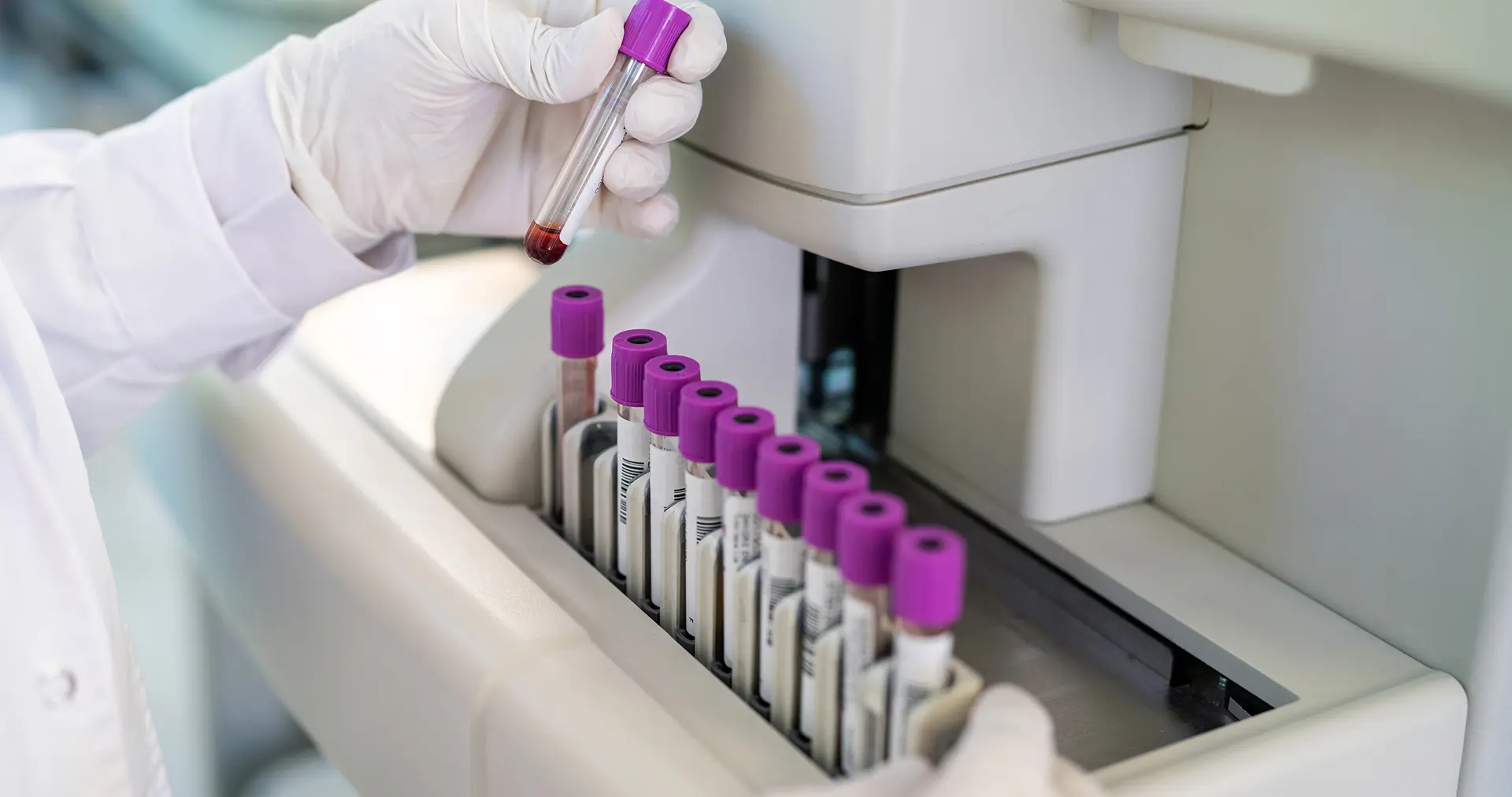 Gloved technician loading purple‑capped blood test tubes into an automated diagnostics analyser