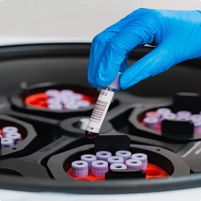 Gloved hand placing a barcoded blood sample tube into a centrifuge rotor holding multiple purple-capped vials.